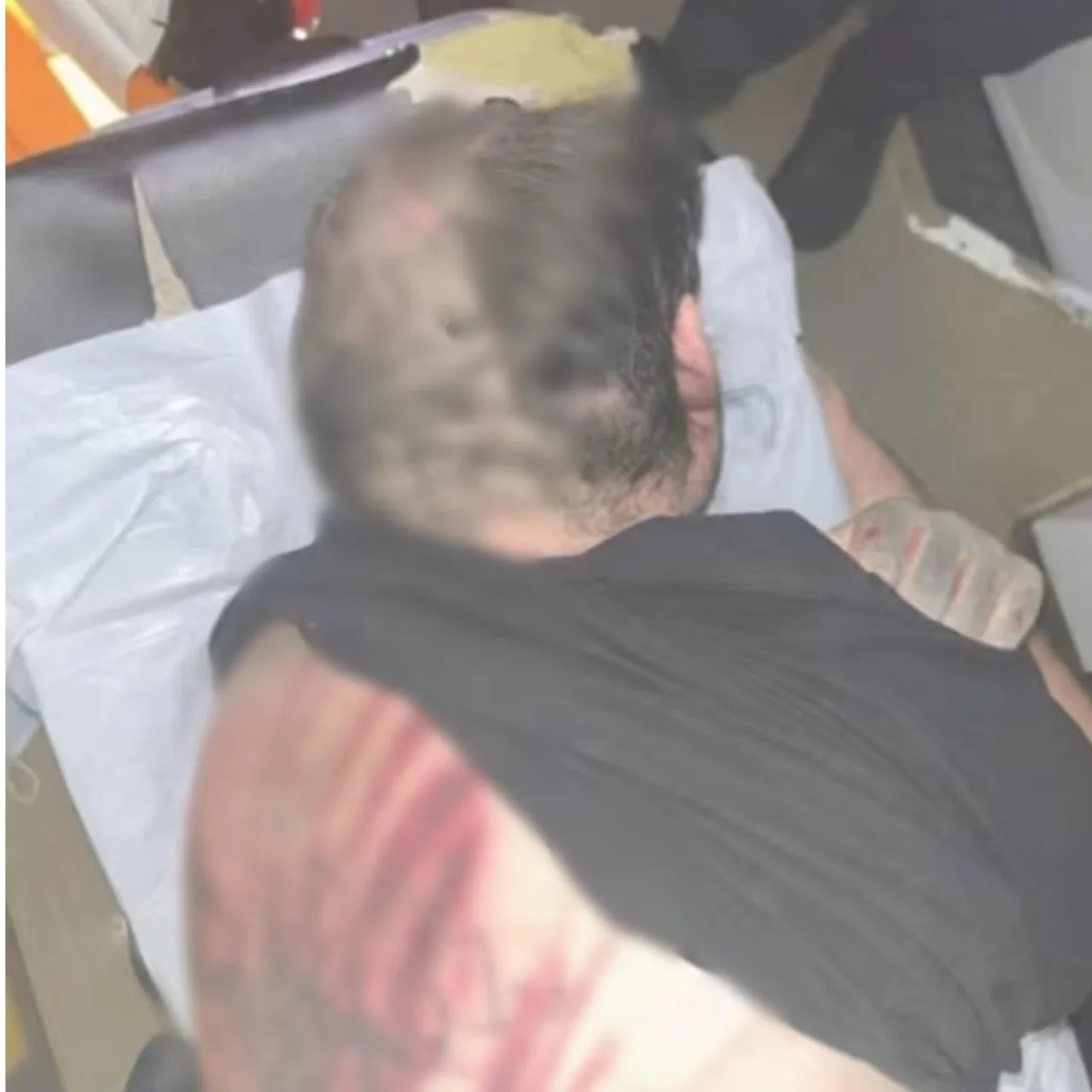 Жестокое нападение на студента в Кишинёве: появились шокирующие фото полученных травм