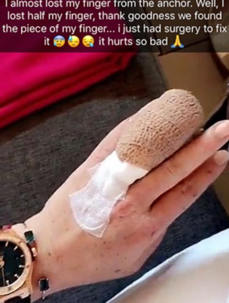 Lindsay Lohan și-a pierdut jumătate din deget, l-a găsit și „l-a cusut” la loc