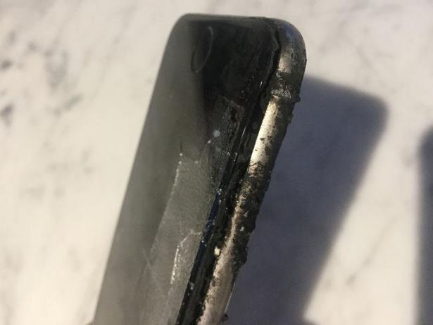 Велосипедисту потребовалась пересадка кожи после взрыва iPhone