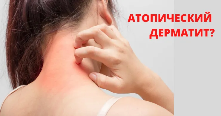 Lactofiltrum Eco: Современный подход к лечению атопического дерматита