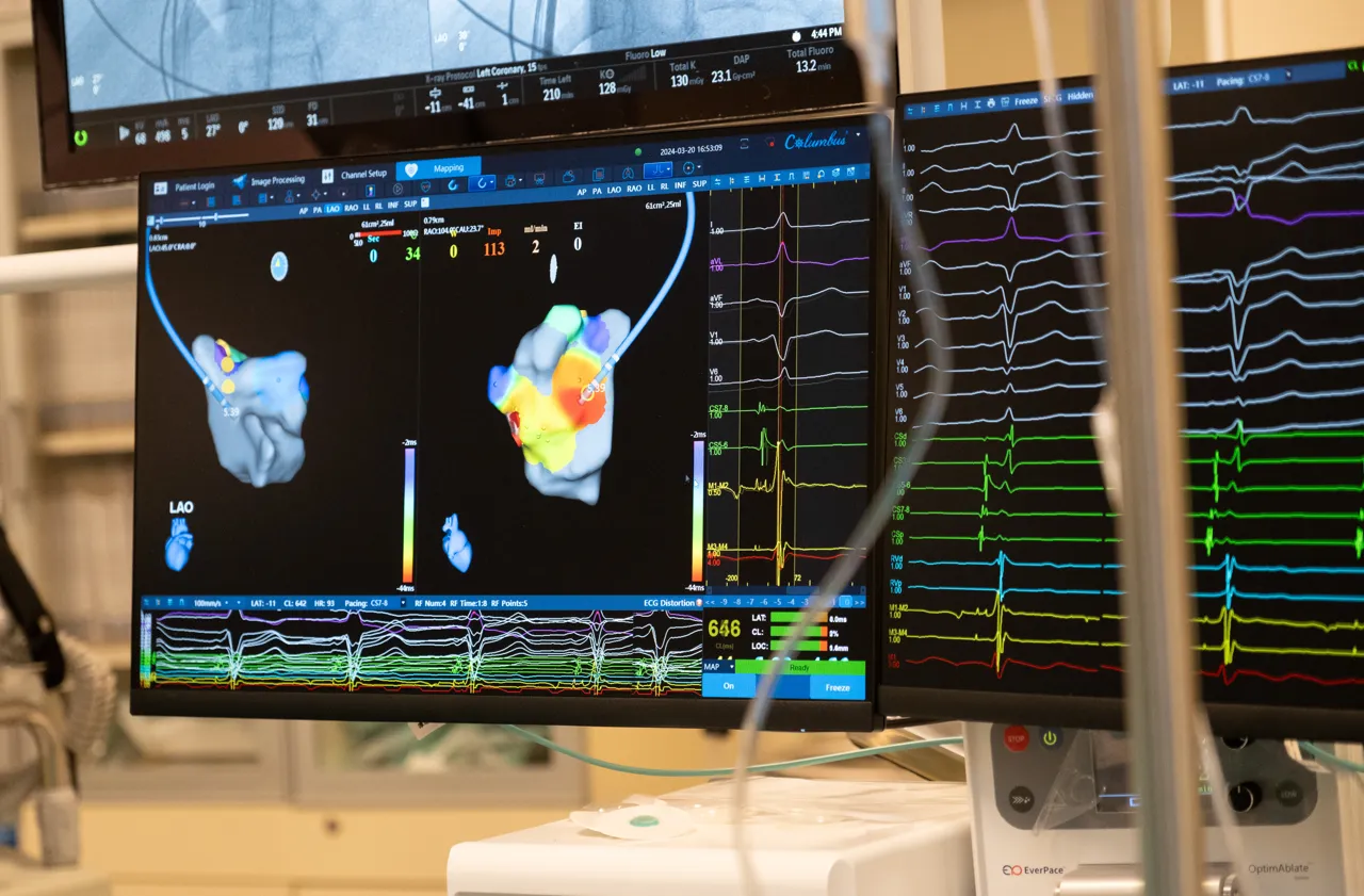 Medpark: Абляция с 3D-картированием – новая технология, избавляющая от аритмии за один день