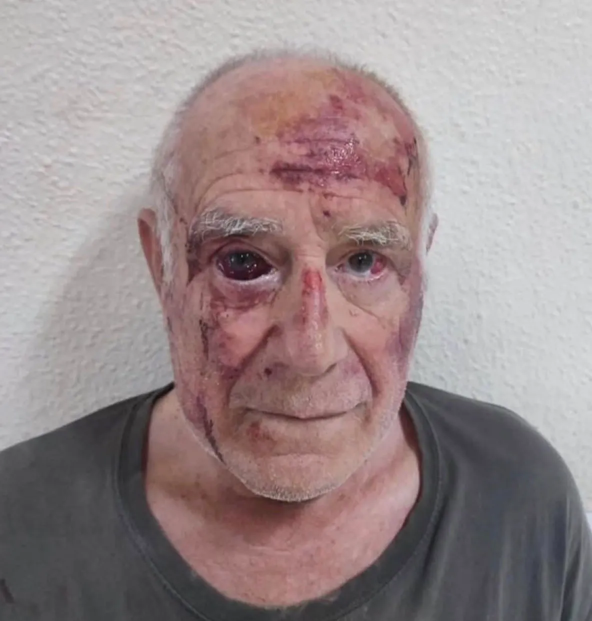 Confruntări violente în Spania între extremiști de dreapta și migranți după agresarea unui pensionar