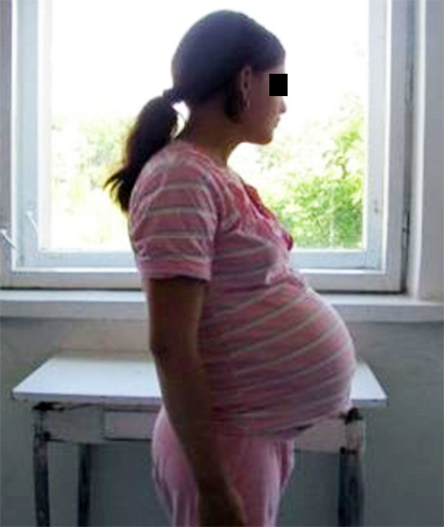 Şocul medicilor: Tânăra este virgină. Cine e tatăl copilului