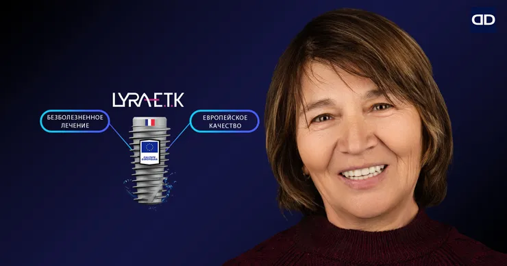 Dentus: 5 причин выбрать европейские зубные импланты Lyra