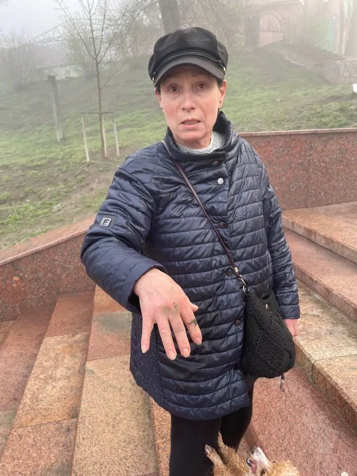 На людей напала стая собак в парке "Валя Морилор": пострадала женщина