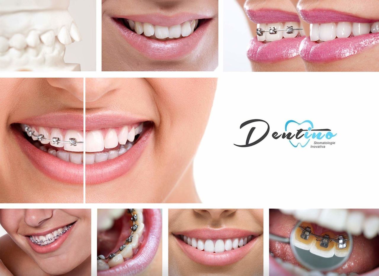 Dentino – Stomatologie inovativă ®