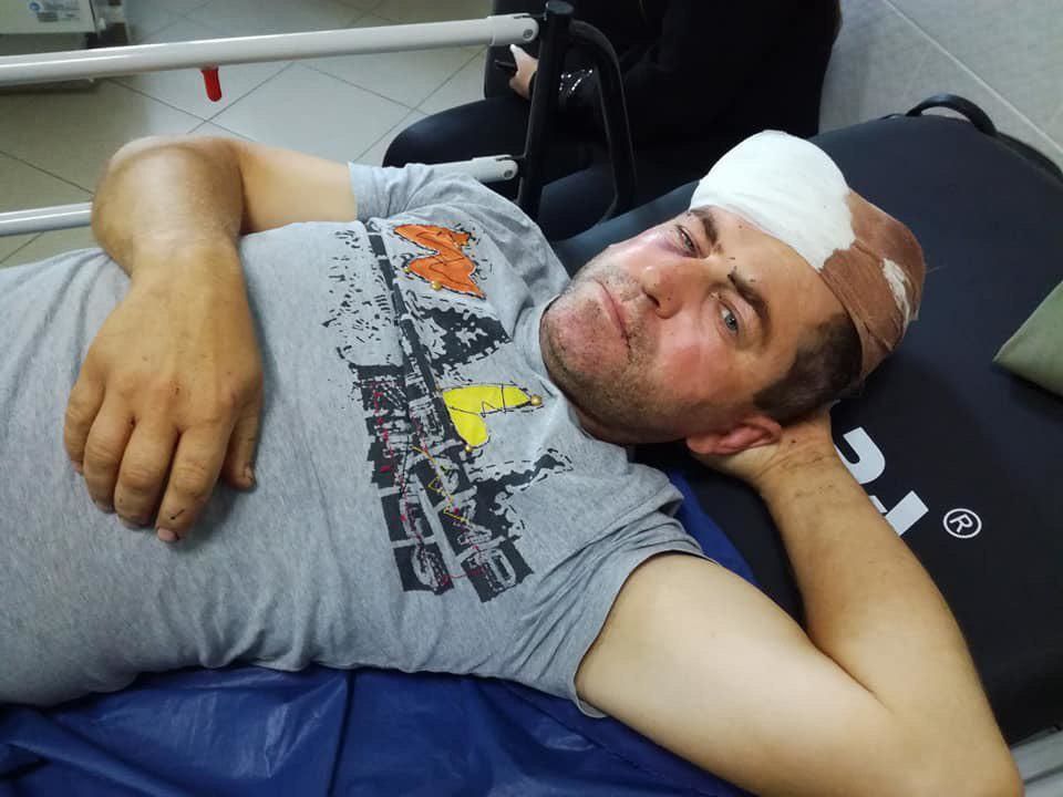 В Каушанах сторонники ДПМ избили местного советника от партии «Демократия - дома»