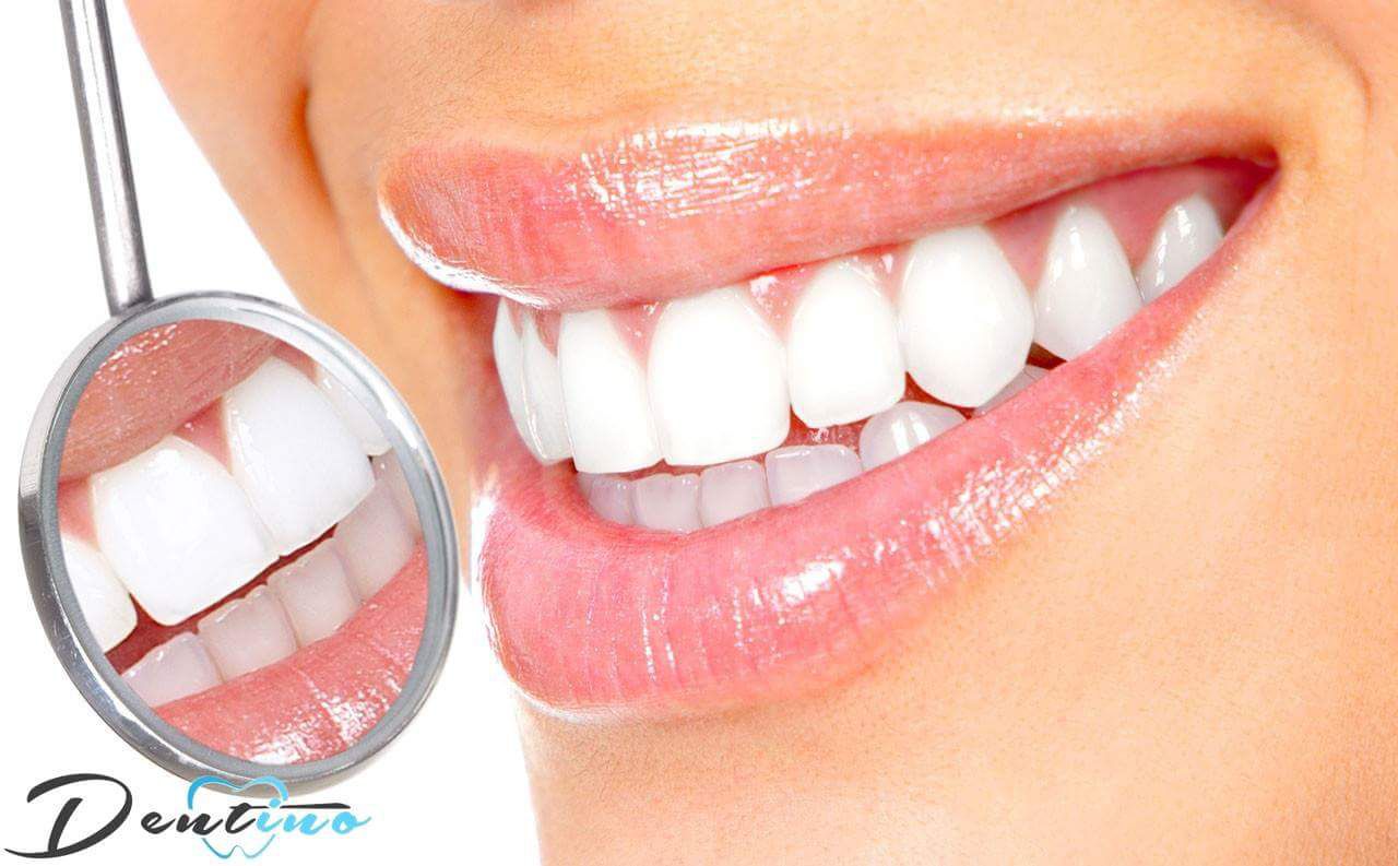 Dentino – Stomatologie inovativă ®
