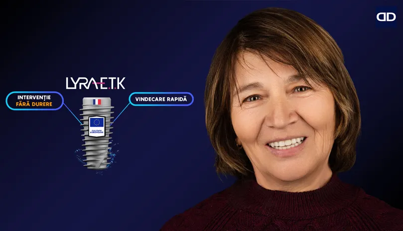 Dentus•Dentino: 5 motive să alegi implanturile dentare europene Lyra