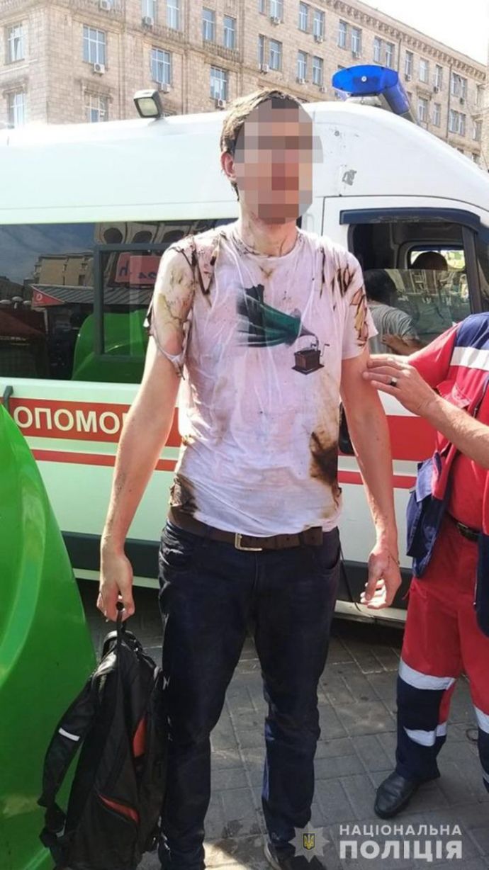 Мужчина поджег себя на параде ко Дню независимости Украины