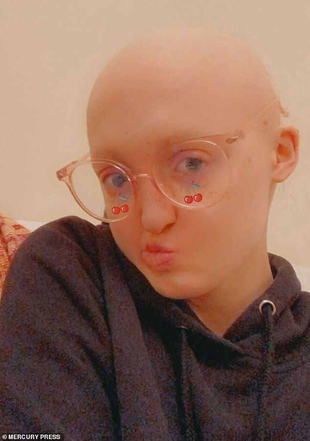 Лысая и глухая девушка с редким заболеванием стала моделью на зависть всем