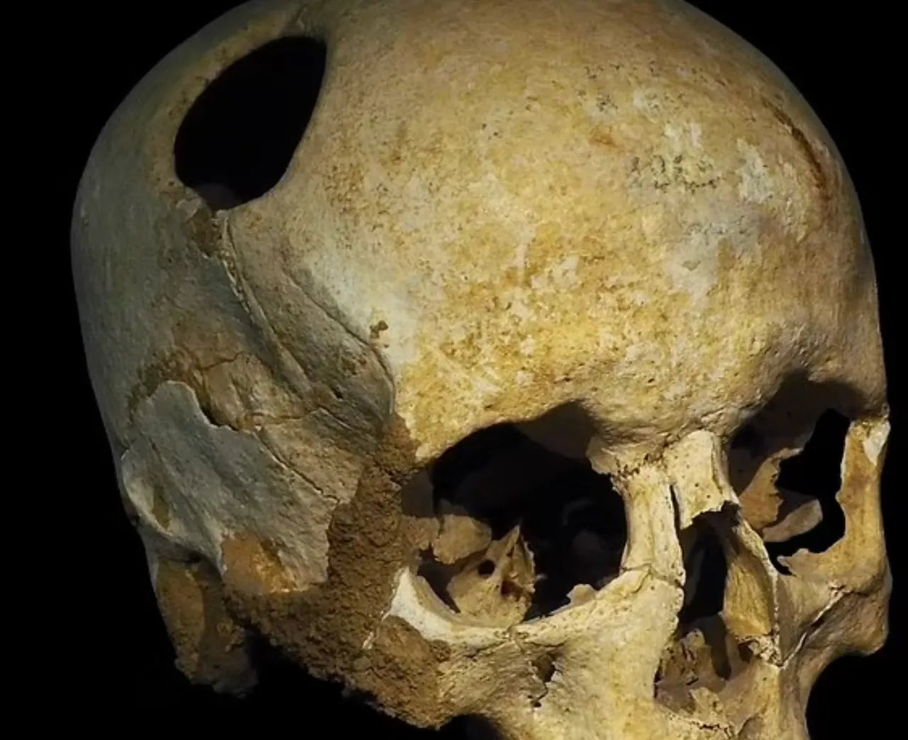 Câțiva muncitori din Argentina au găsit rămășițe ale „omului-furnică”: Craniul are o formă neobișnuită