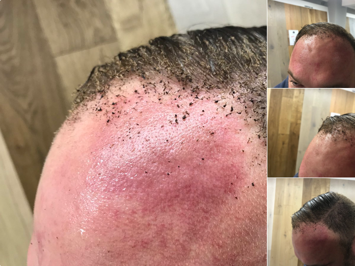 Primele imagini cu victimele exploziei de la Londra