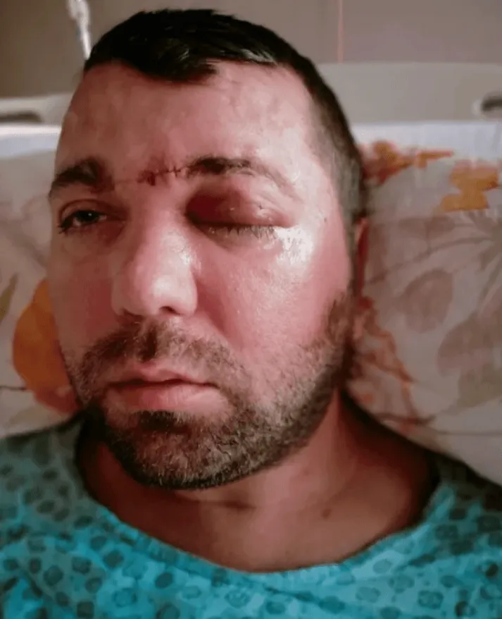 В Турции стоматолог вкрутил зубной имплантат в мозг пациента