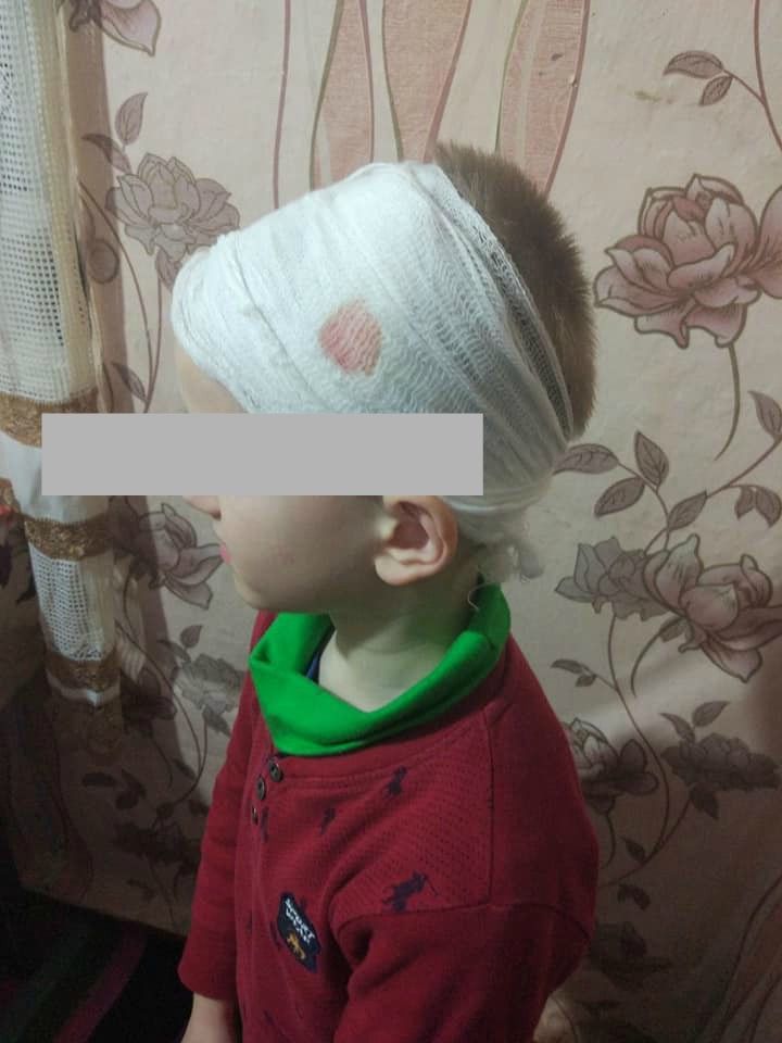 Женщина обвиняет воспитателя в том, что у ребенка травма головы
