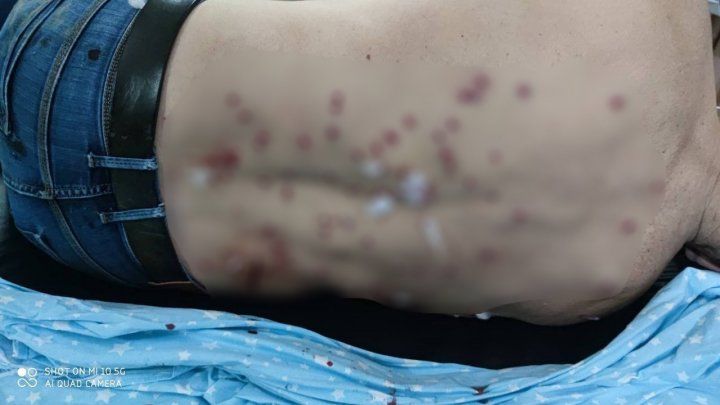 В столице нашли мужчину, в которого стреляли в Сипотенах