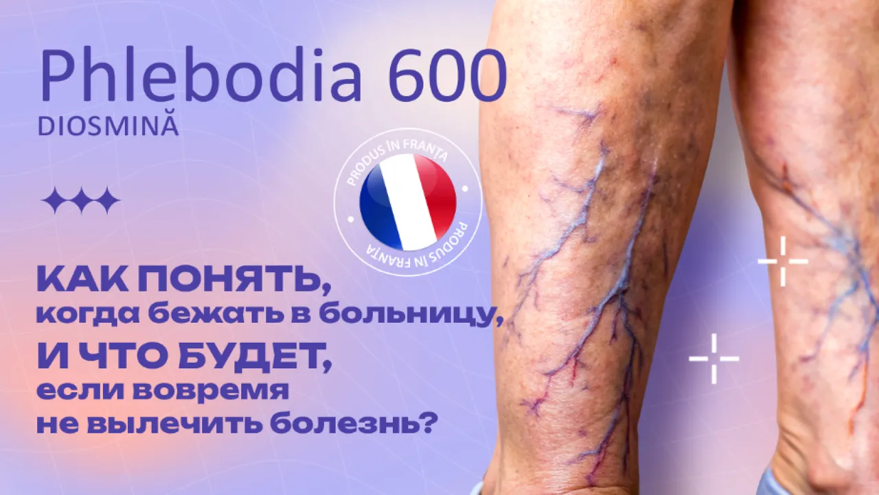 Phlebodia 600: Как понять, когда бежать в больницу, и что будет, если вовремя не вылечить болезнь