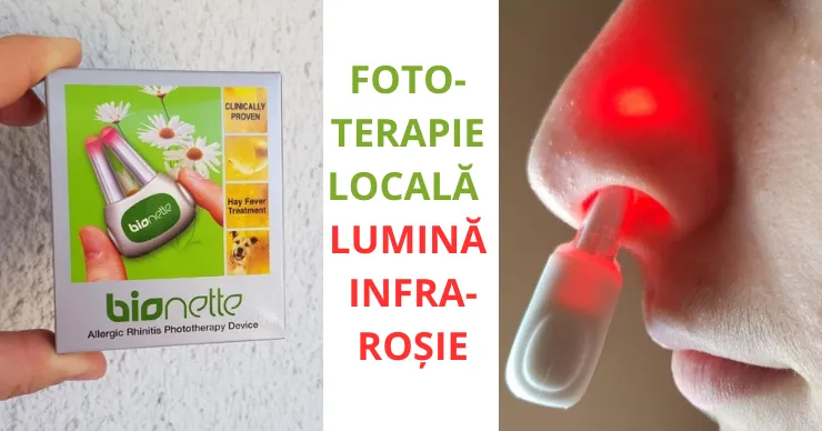 Bionette – soluția inovatoare împotriva rinitei alergice