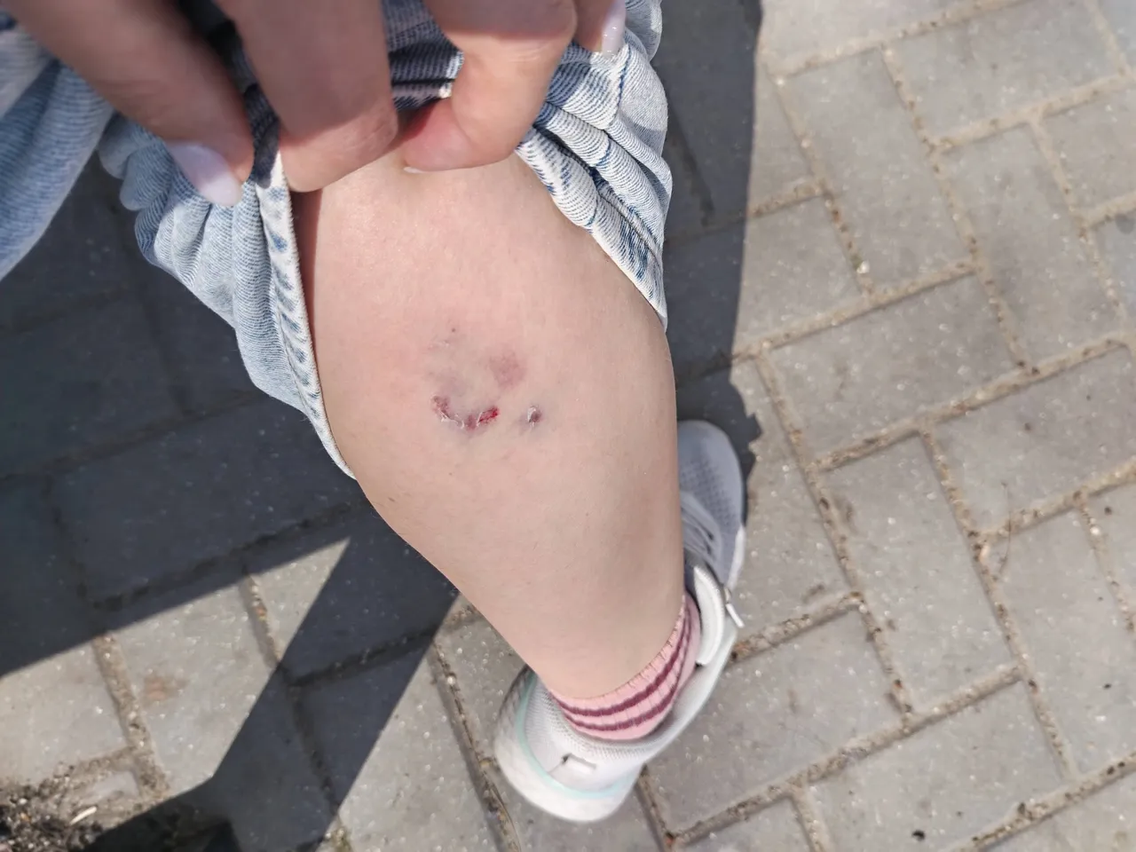 O femeie, atacată de o haită de câini vagabonzi la Vadul lui Vodă