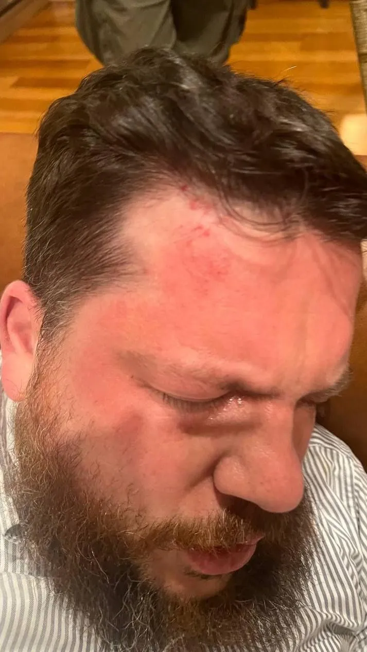 В Вильнюсе напали с молотком на соратника Навального Леонида Волкова