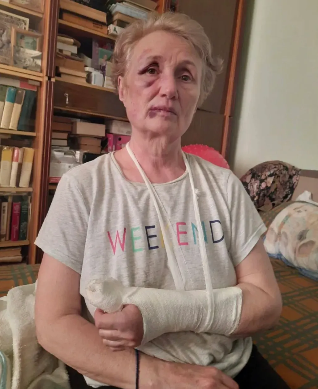 В Кишиневе избили женщину: Она била меня металлической тростью