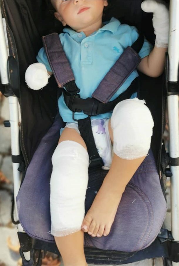 В Одессе ребенок получил ожоги, упав на скульптуру
