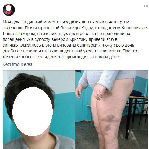 Coșmarul unei mame. O adolescentă a fost umplută de vânătăi în Spitalului Clinic de Psihiatrie din orașul Codru