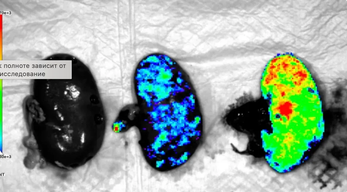Bioinginerii au creat primul rinichi hibrid om-porc din lume
