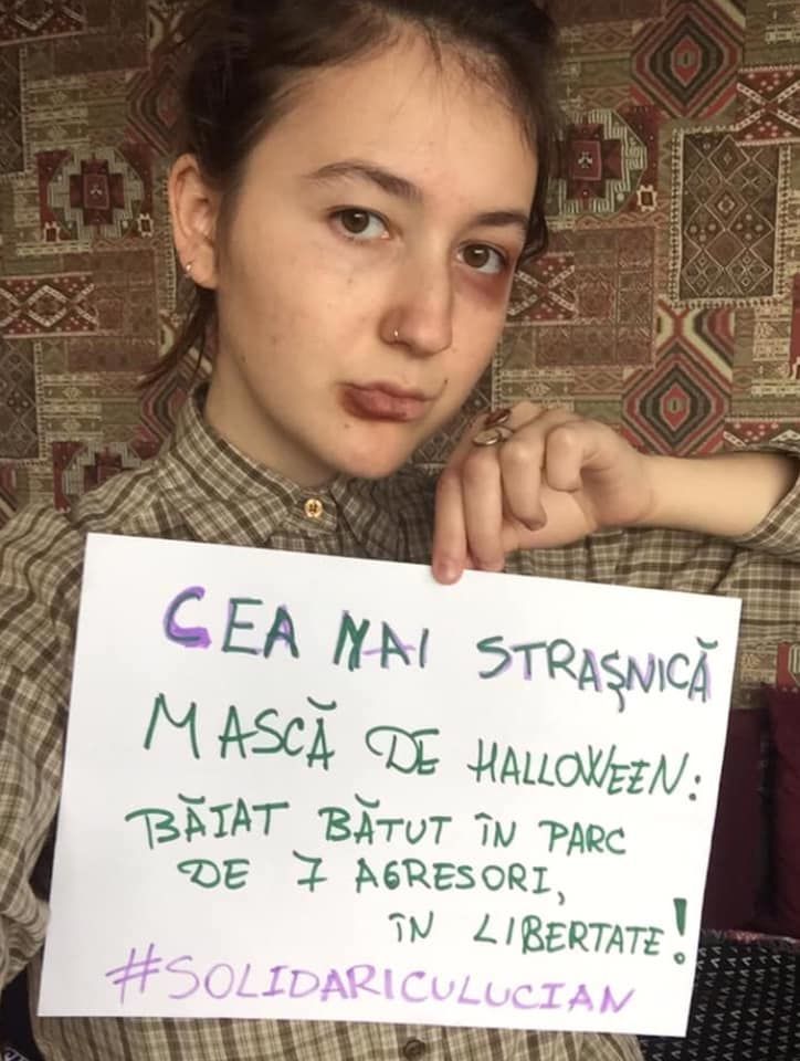 В Сети запустили кампанию солидарности с избитым в Кишиневе юношей