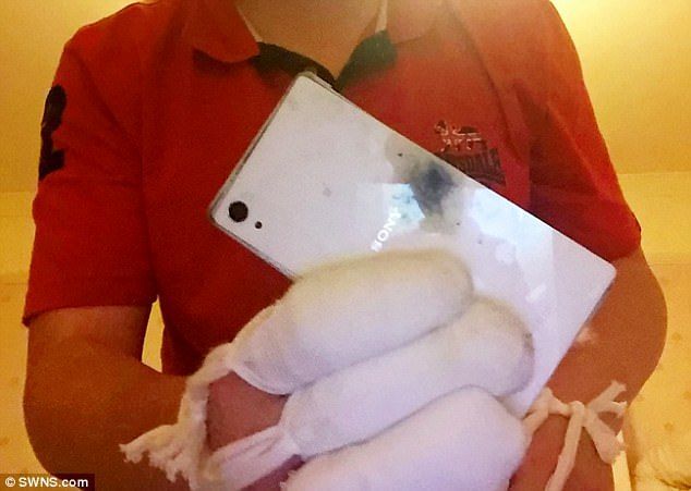 У мужчины в руках взорвался телефон Sony: он получил сильные ожоги