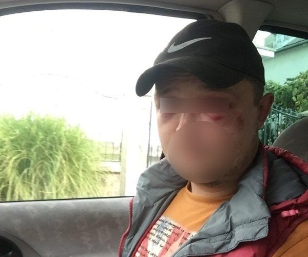На Закарпатье грибников избили всем селом