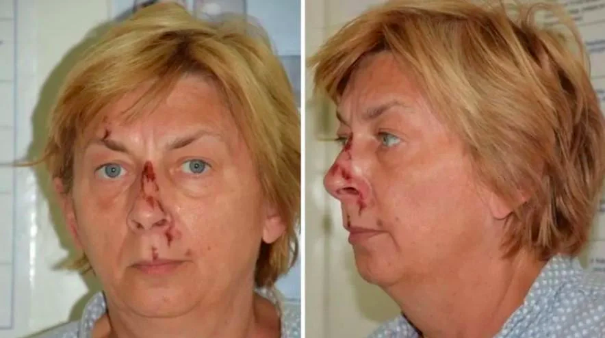 На острове в Адриатическом море нашли женщину, потерявшую память