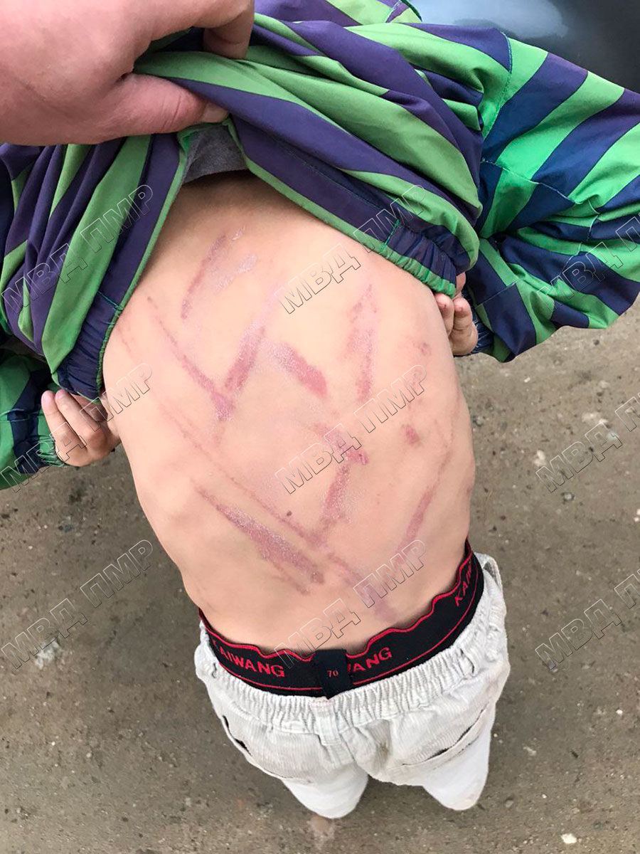 В Приднестровье мужчина жестоко избил своих детей