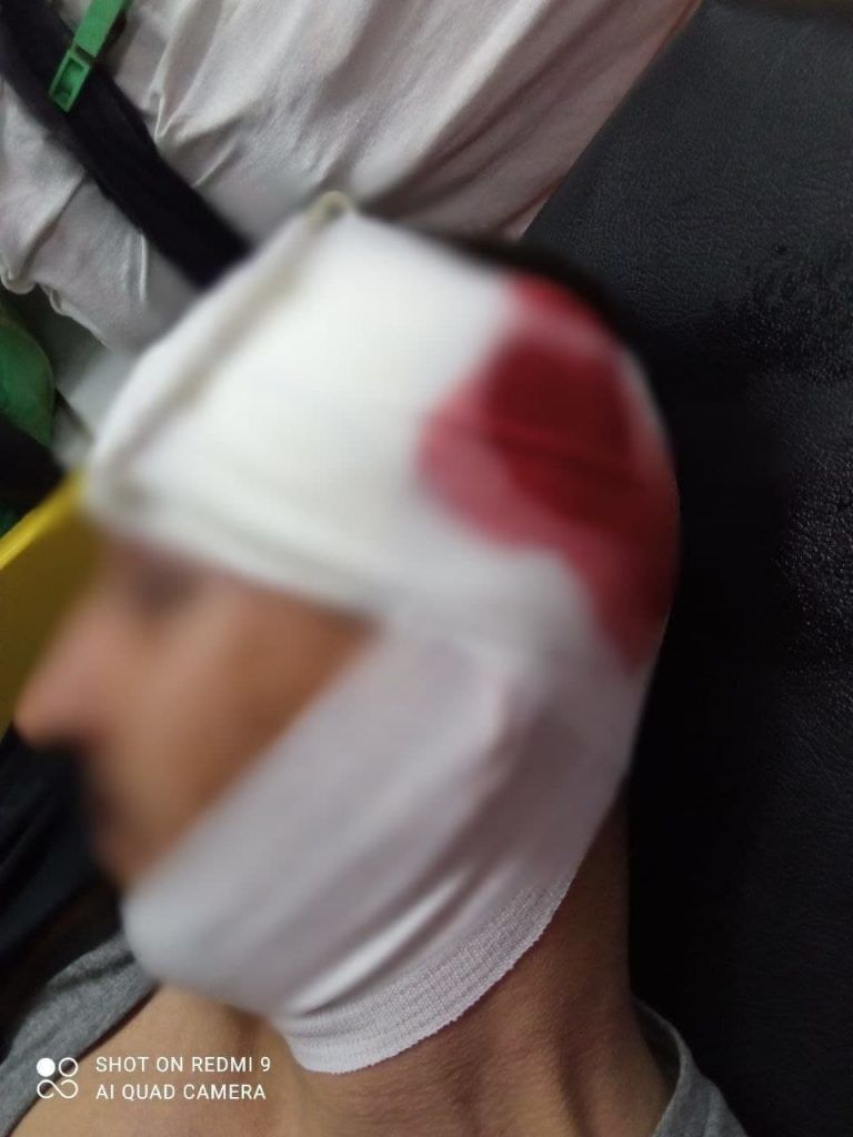 Карабинеры дважды за день пришли на помощь жителям Кишинева, обнаруженным без сознания