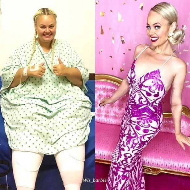 Женщина похудела на 88 килограммов, чтобы стать похожей на Барби