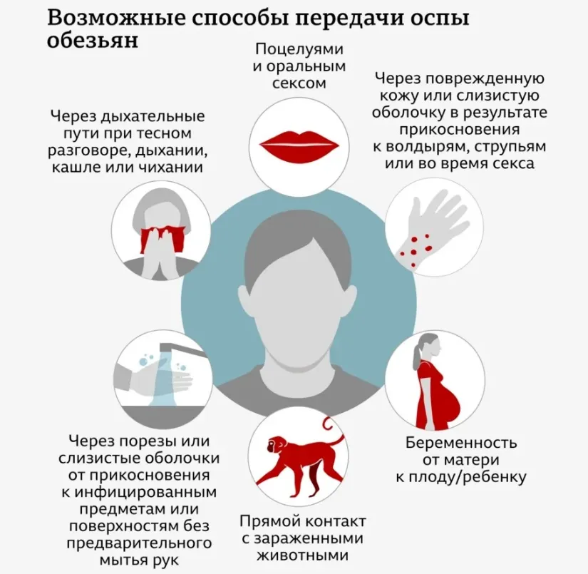 Эксперт ВОЗ: Оспа обезьян — это не новый ковид, методы борьбы понятны