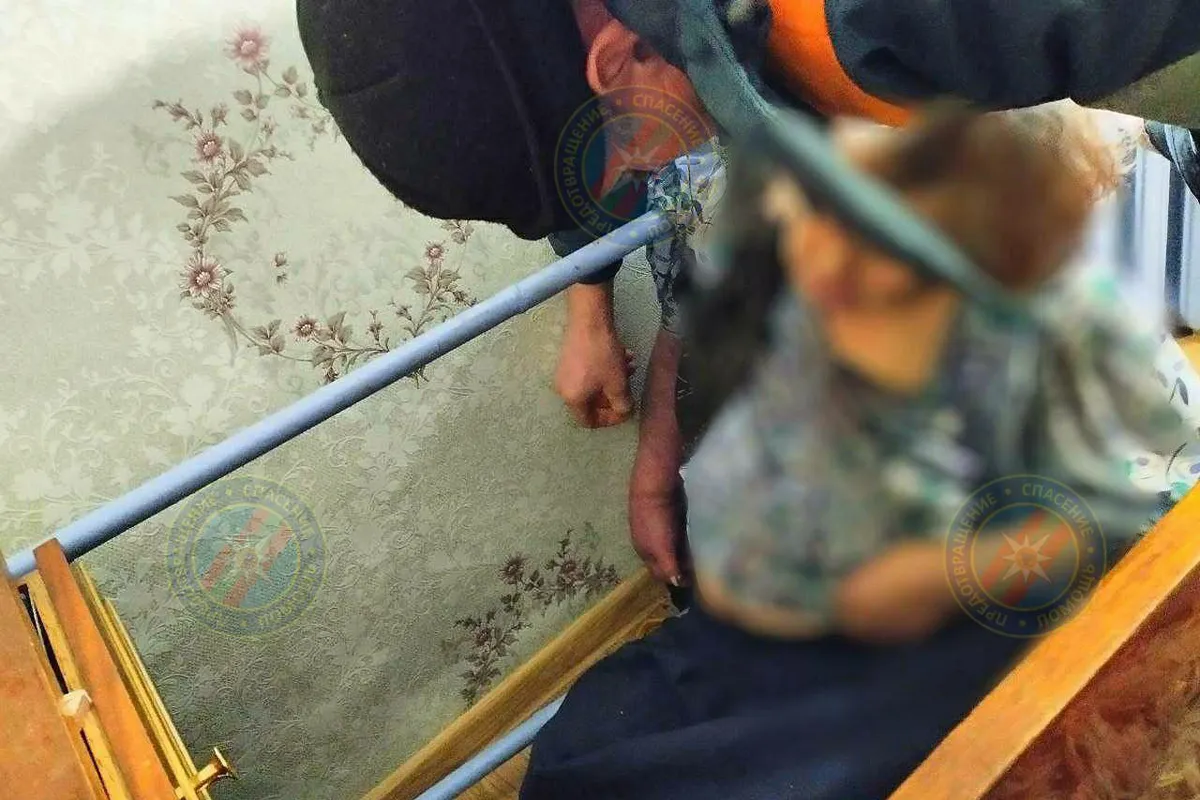 В Слободзее женщина получила ожоги: рука застряла между трубой и стеной