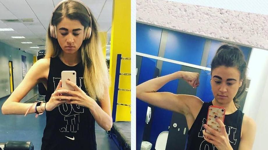 Англичанку не пускали в самолет из‐за сильной худобы