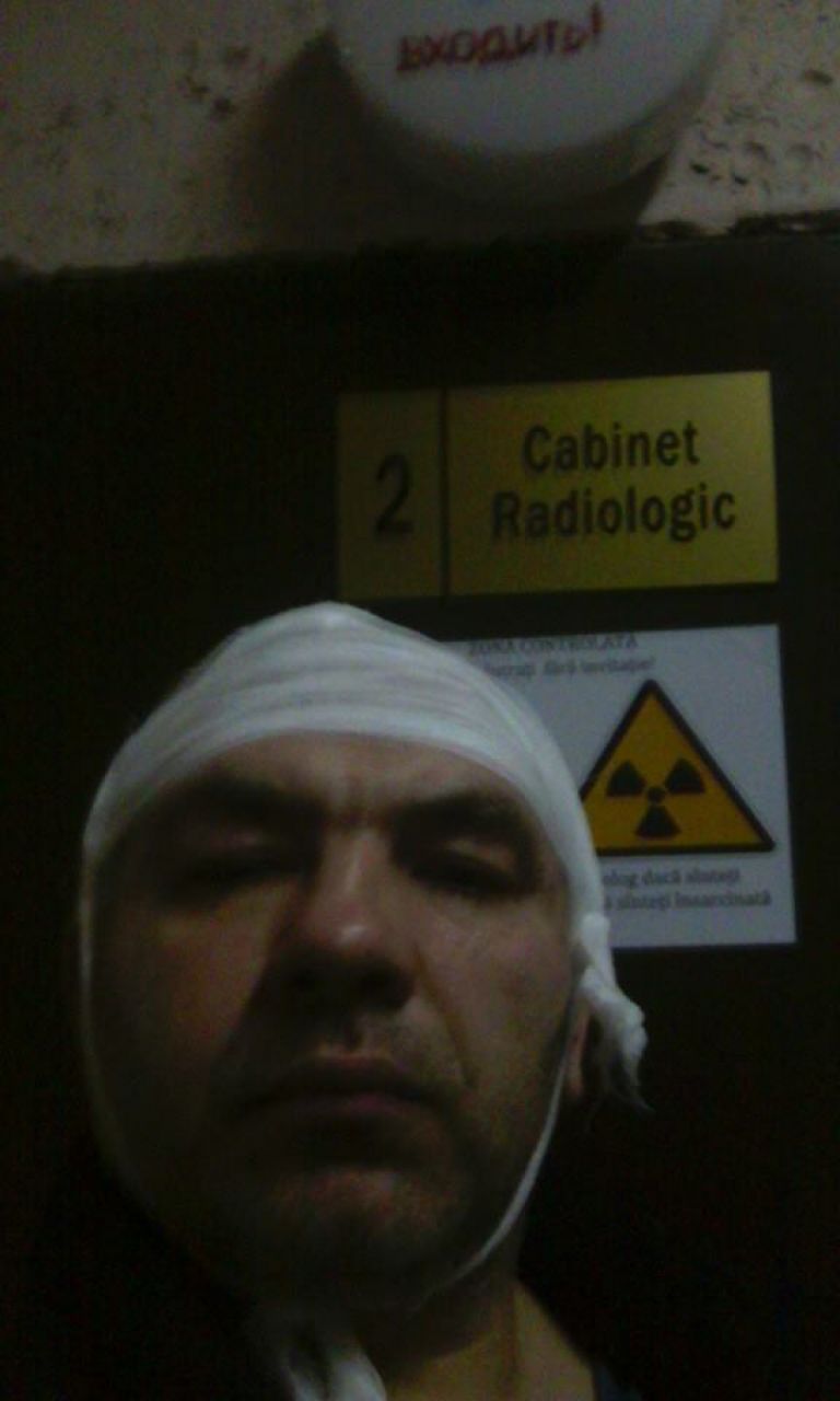 Anatol Mătăsaru, atacat: A ajuns cu capul spart la spital
