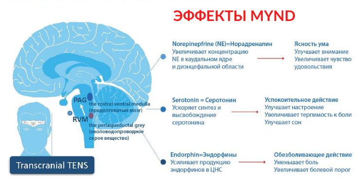 Mynd: В Англии разработан аппарат для лечения головных болей без лекарств