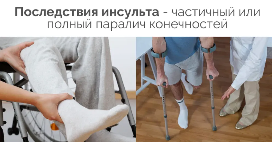 Step-On после инсульта: как отказаться от трости или костылей