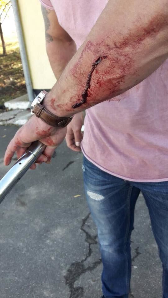 Un bărbat, agresat de angajatul Autosalubritate: Nu dorea să-i dea câinele