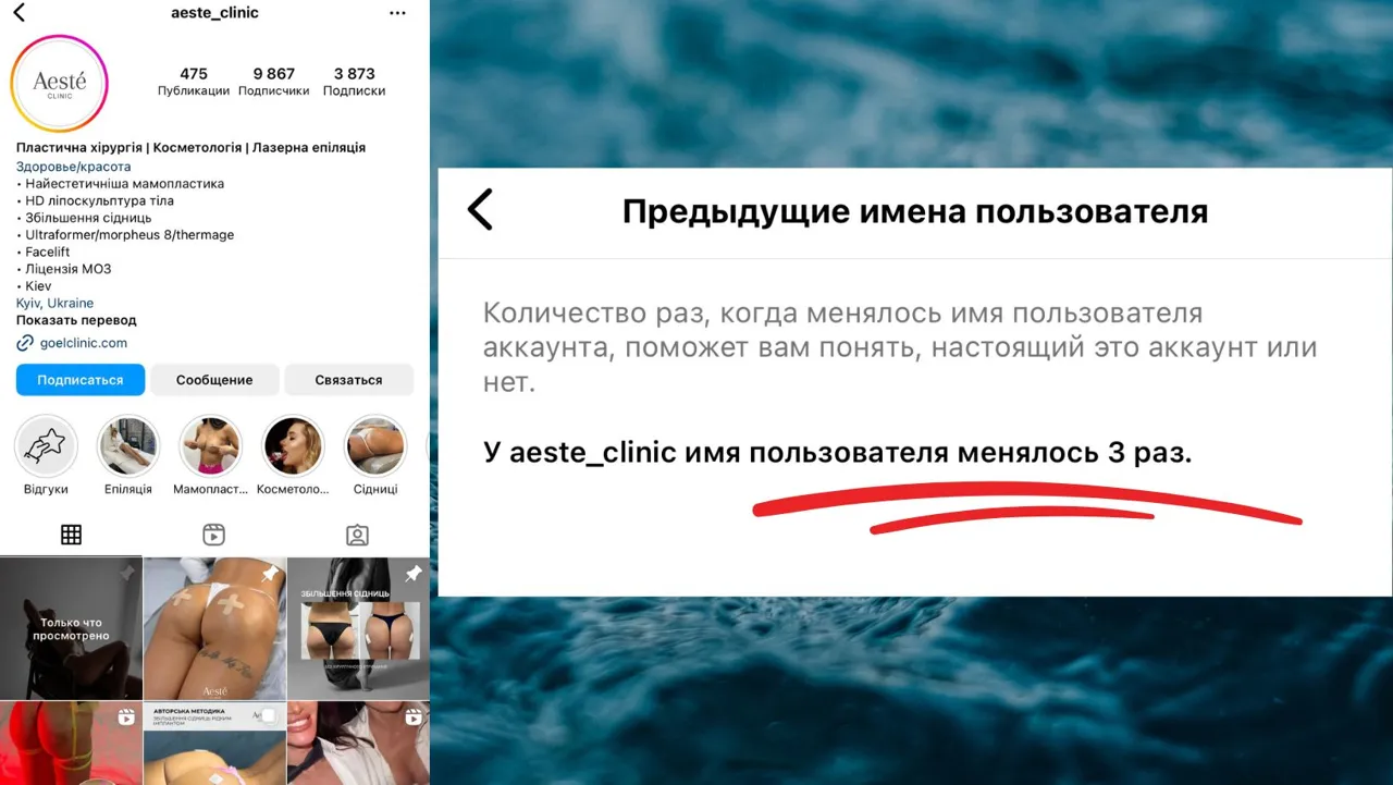 Dr. Serebrova, Irina Borodkina, își șterge urmele: A schimbat numele clinicii de chirurgie plastică din Kiev