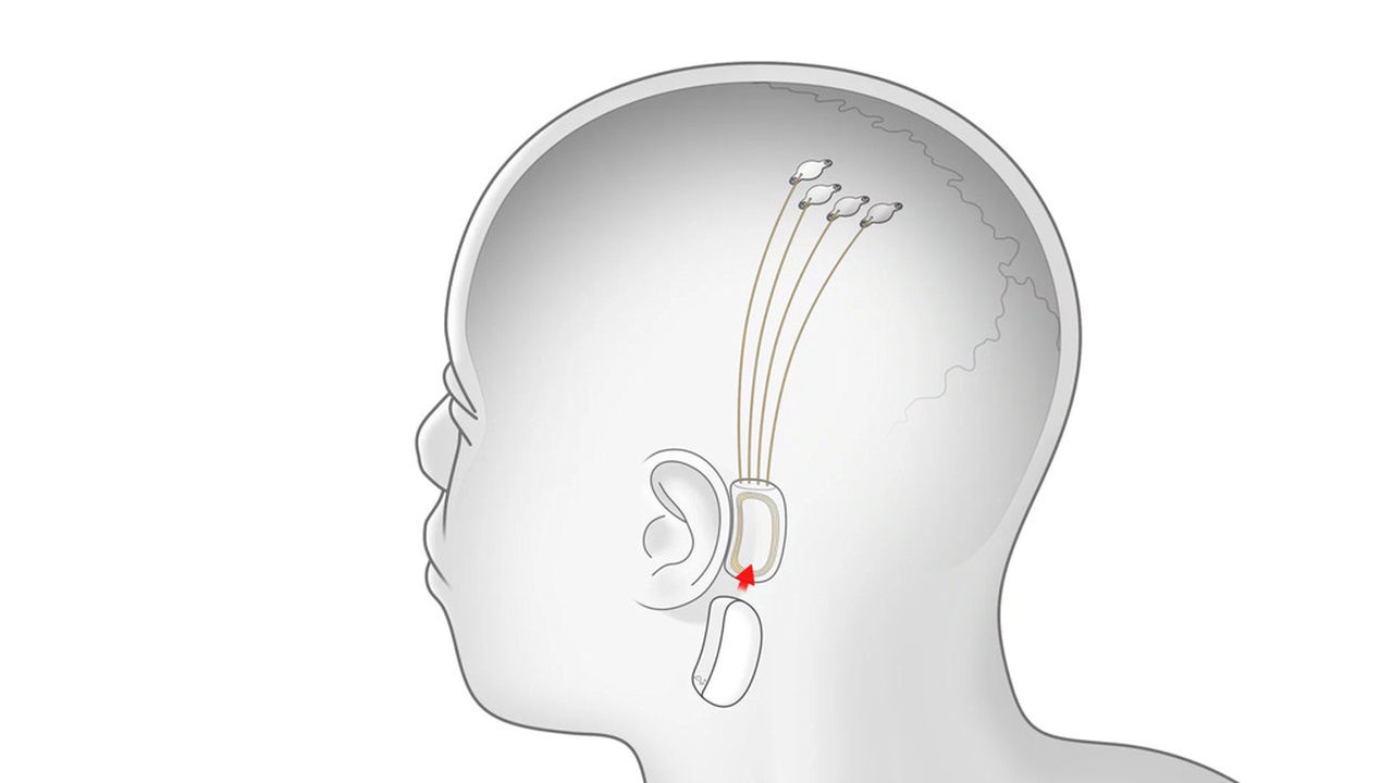 Компания Илона Маска Neuralink впервые показала разработки
