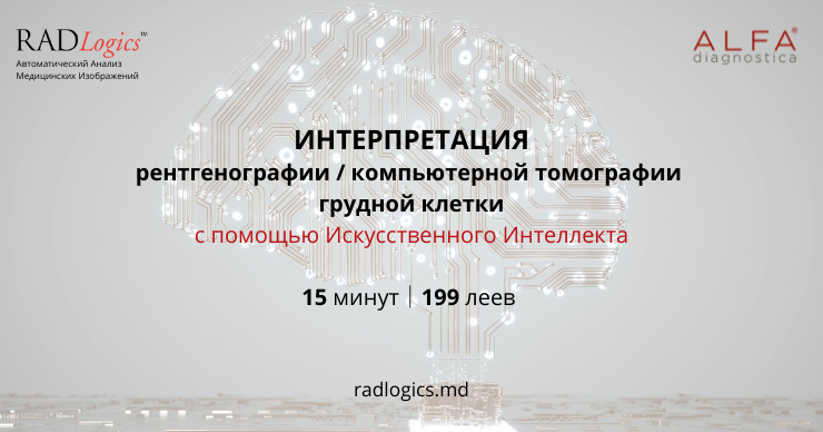 Alfa Diagnostica: Искусственный интеллект распознает COVID-19 пневмонию