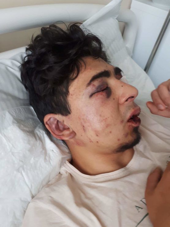 Отец пострадавшего в центре города парня: Преступников отпустили в тот же вечер