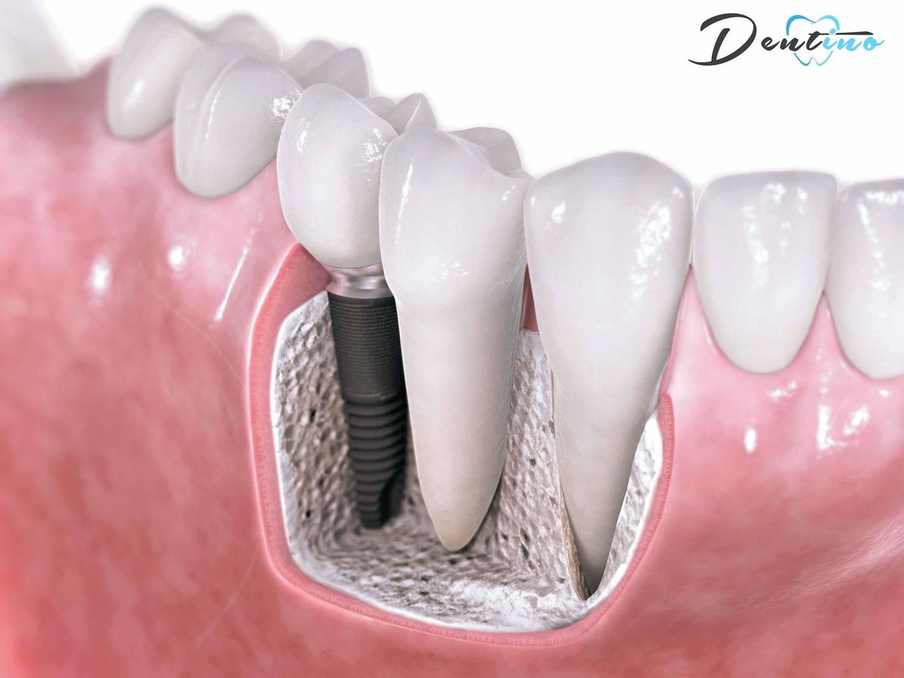 Dentino – Stomatologie inovativă ®