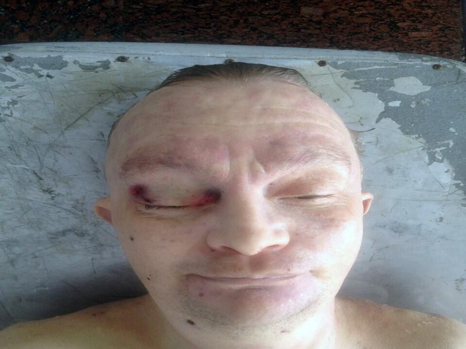 Explozia din Chişinău: Poliţia cere ajutor pentru a identifica una dintre victime