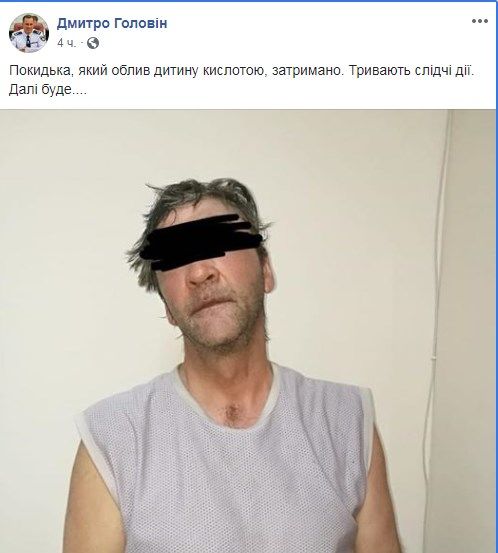 Житель Одессы облил кислотой игравшего под его окнами мальчика