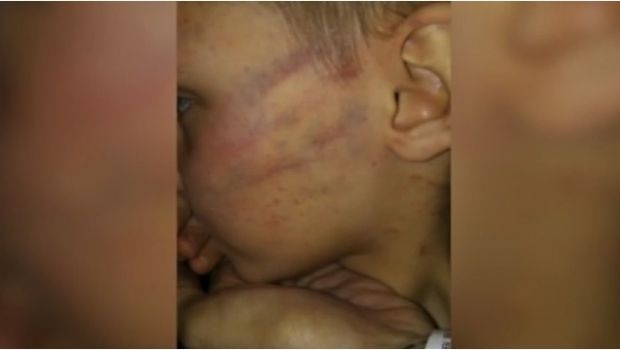 Copil bătut pentru că a deschis un cadou pus sub bradul de Crăciun